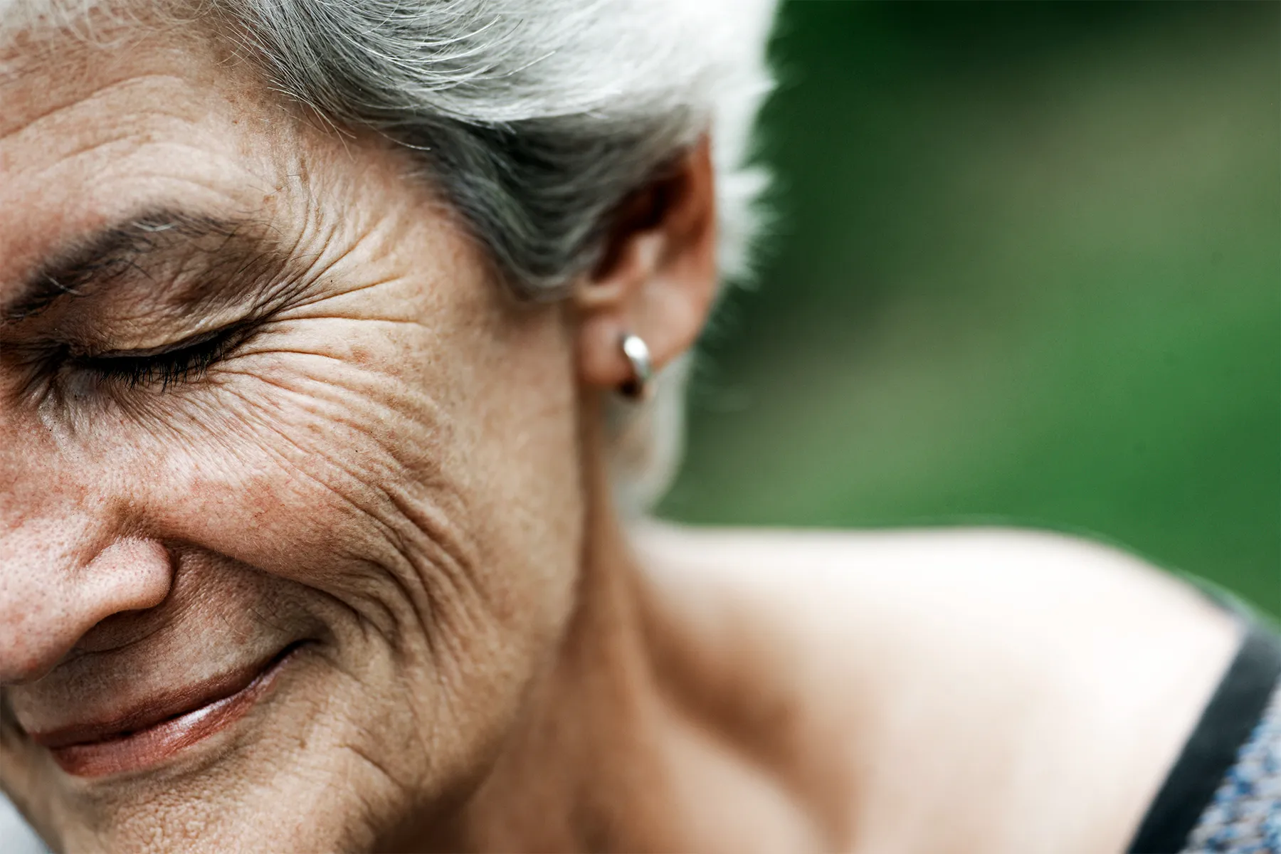 Fine Lines / Wrinkels