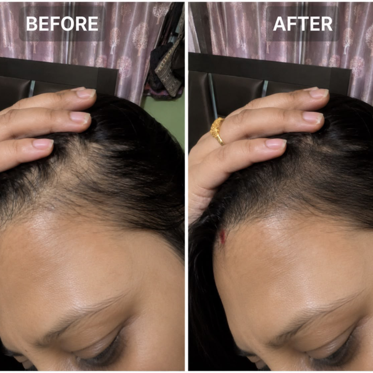 before_after_hair_1x1