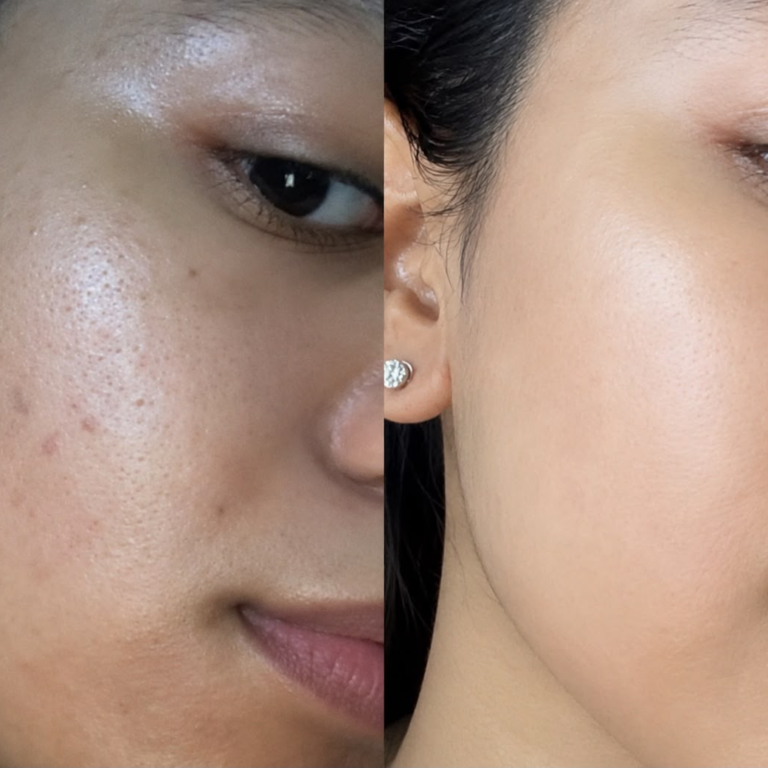 skin_before_after_1x1